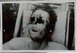 Fotos del horror. Dos fotografías de un joven falangista torturado